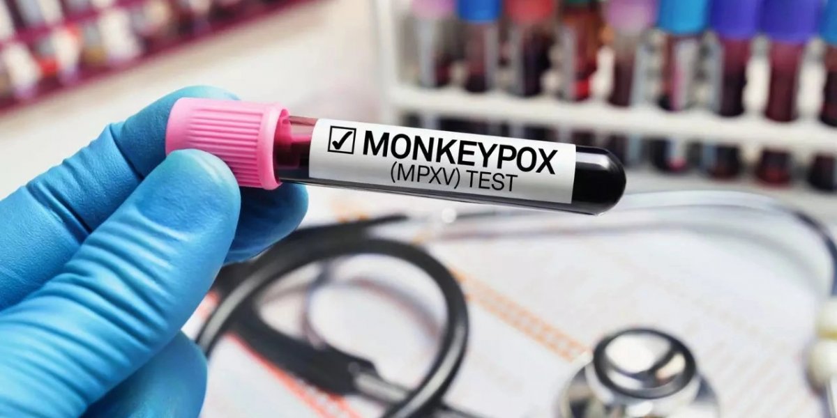 Diretor europeu da OMS alerta que Mpox não é uma ‘nova Covid-19’